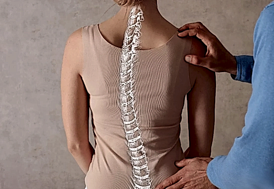 Duruş Bozukluğunuz Sizi Rahatsız mı Ediyor?