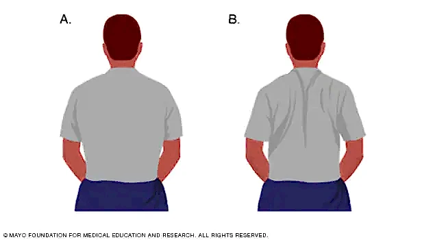 Kürek Kemiği Sıkıştırma (Shoulder Blade Squeeze)